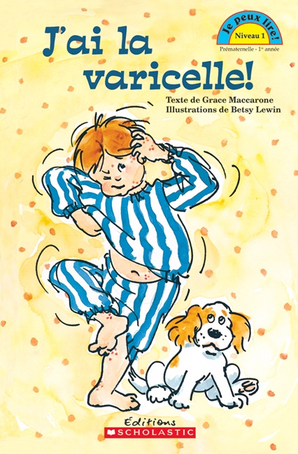 J'ai la varicelle!